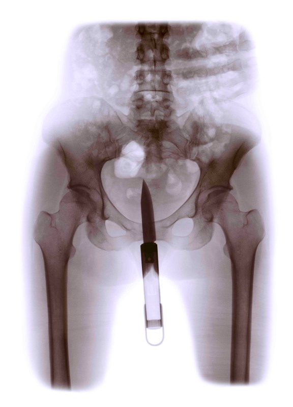 Aperçu de la thématique Femmes et féminisme